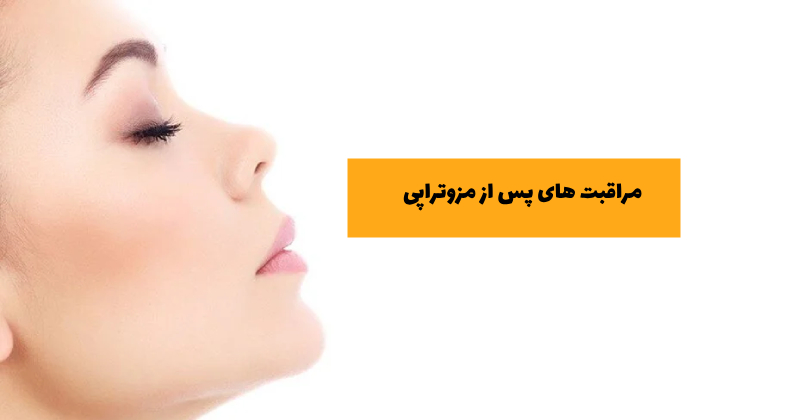 مراقبت های پس از مزوتراپی